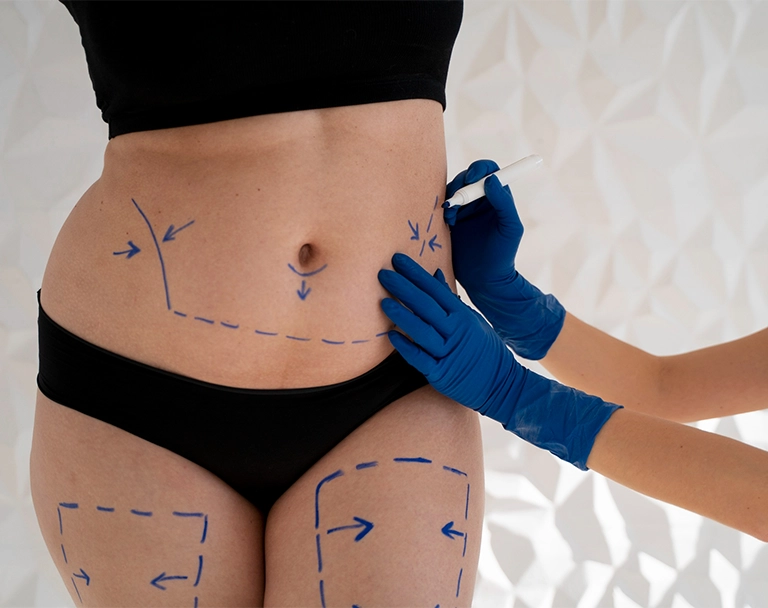 body-contouring SF Med Aesthetics