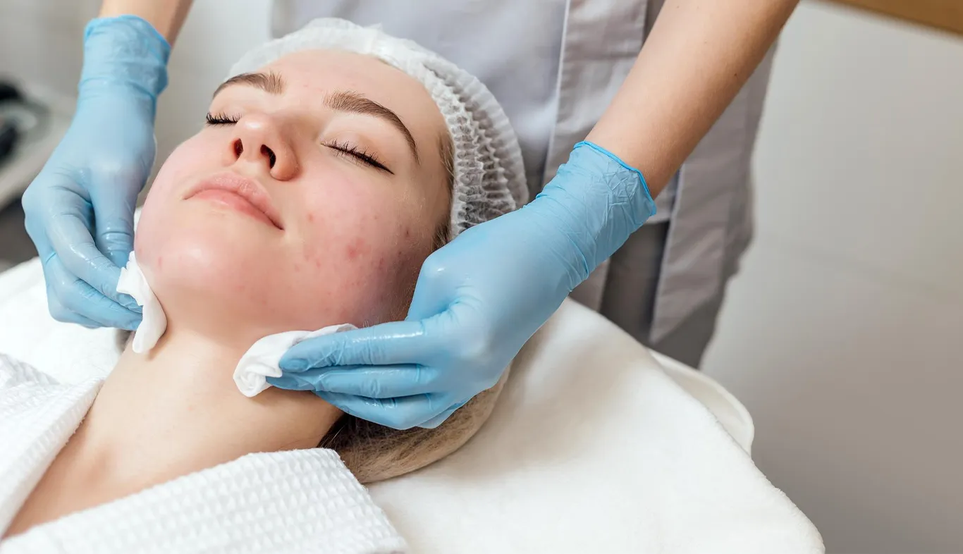 Discover Dr. Sadaf Farooqi’s Advanced Acne Scar Treatment Protocol