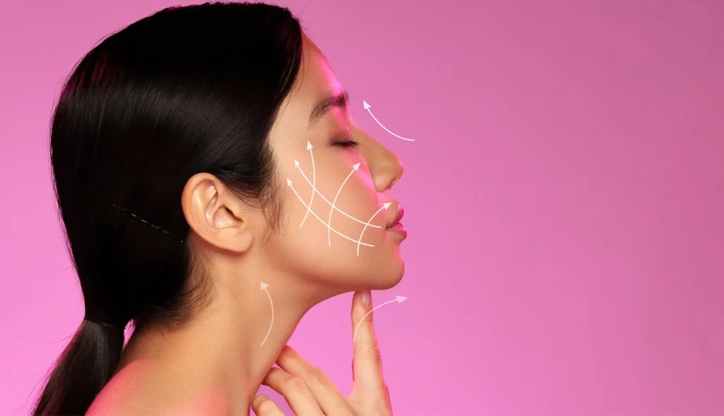 Quantum RF Contouring Restores a Defined Jawline