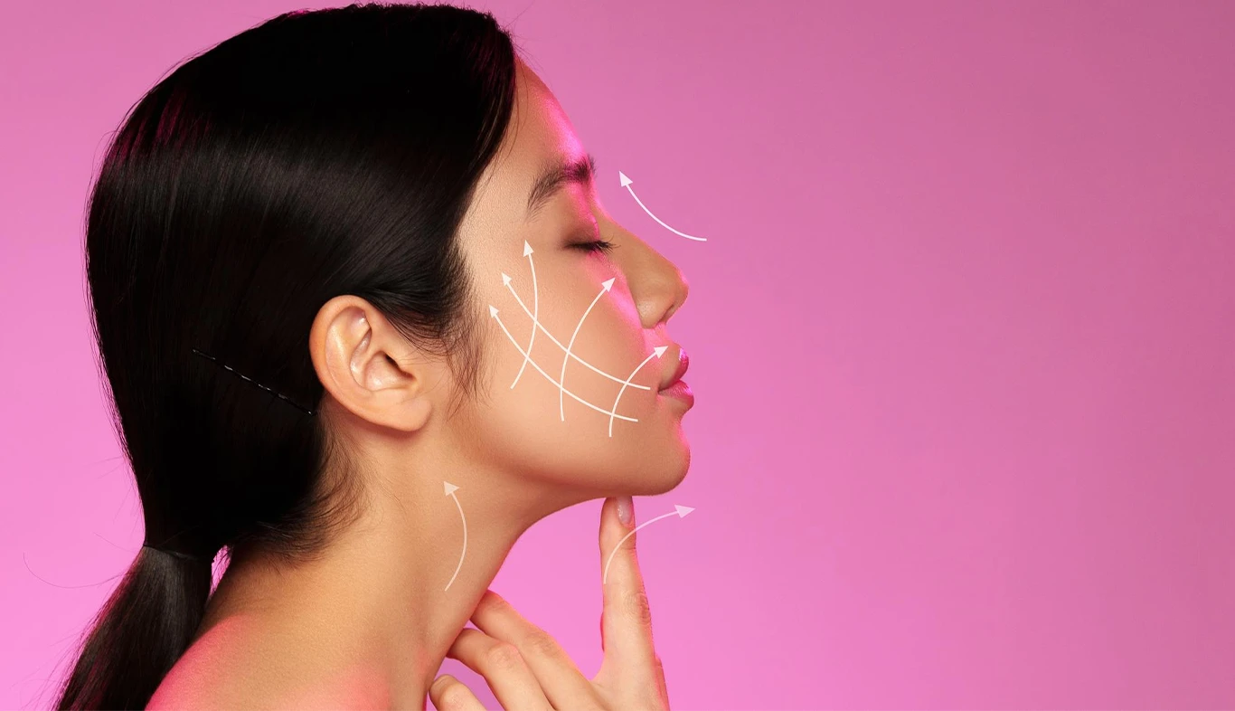 Quantum RF Contouring Restores a Defined Jawline
