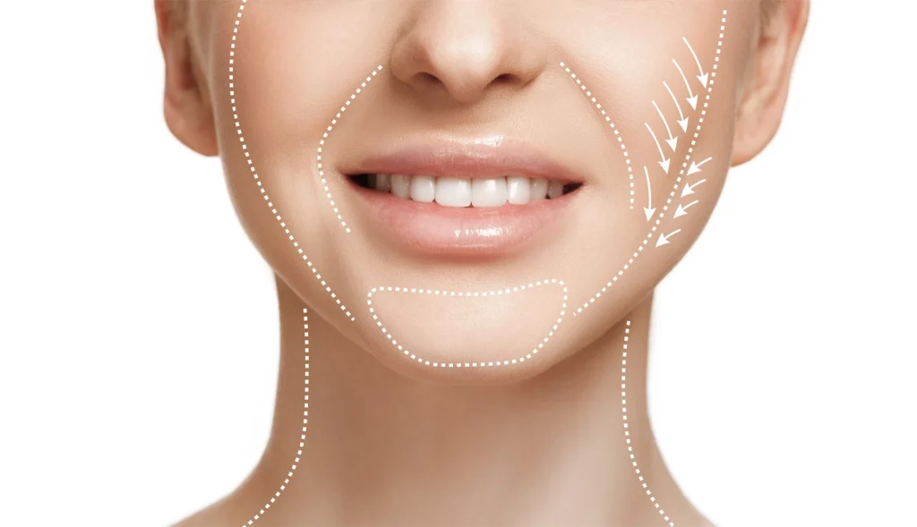 Why XERF™ Is the Premier Non-Invasive Solution for Early Jowling and Jawline Sagging